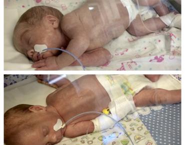 Наши малышки в реанимации