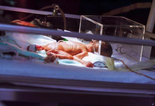 БЛД недоношенных